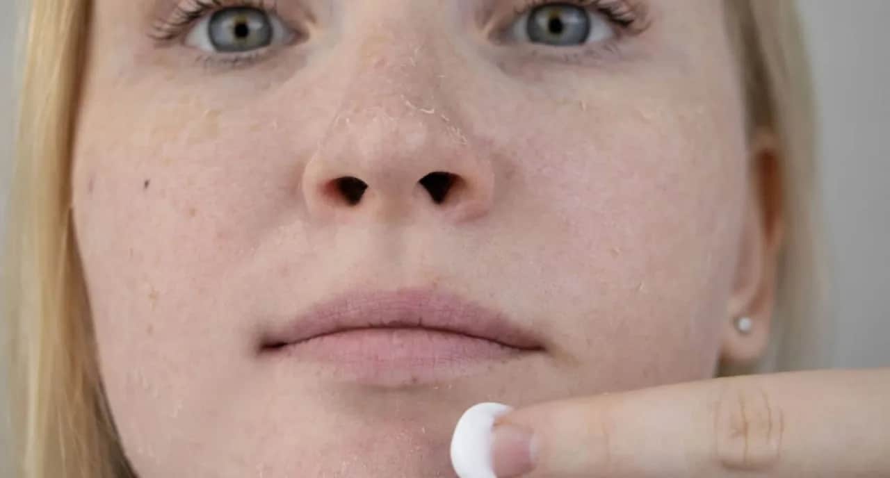 Juckende Gesichtshaut: Die wahren Ursachen & effektive Hilfe